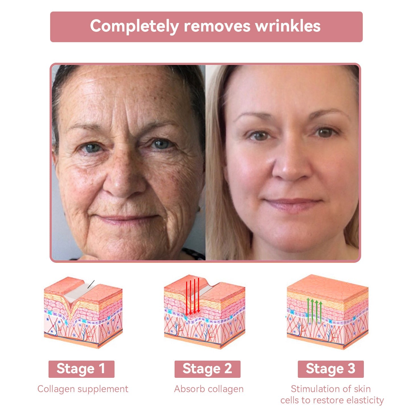 Coenzyme Q10 Collagen Jelly Skin Cream-The Guardian Praised Product (UP TO 80% OFF, Christmas ONLY!)🏵️