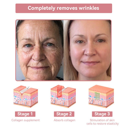 Coenzyme Q10 Collagen Jelly Skin Cream-The Guardian Praised Product (UP TO 80% OFF, Christmas ONLY!)🏵️