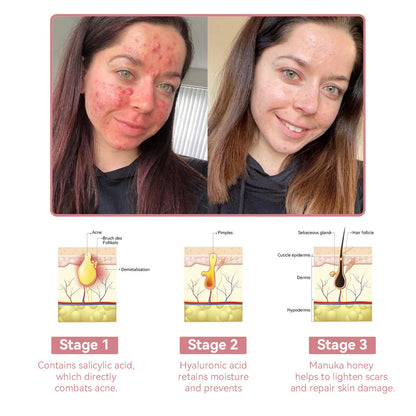 Coenzyme Q10 Collagen Jelly Skin Cream-The Guardian Praised Product (UP TO 80% OFF, Christmas ONLY!)🏵️