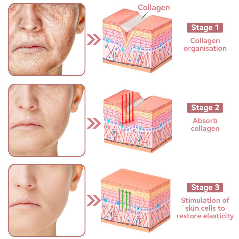 Coenzyme Q10 Collagen Jelly Skin Cream-The Guardian Praised Product (UP TO 80% OFF, Christmas ONLY!)🏵️
