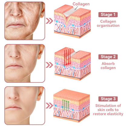 Coenzyme Q10 Collagen Jelly Skin Cream-The Guardian Praised Product (UP TO 80% OFF, Christmas ONLY!)🏵️